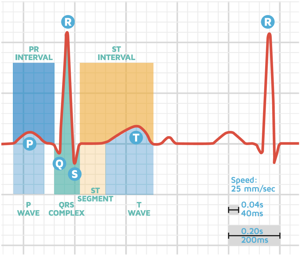 How To Read Your ECG BUZUD Singapore
