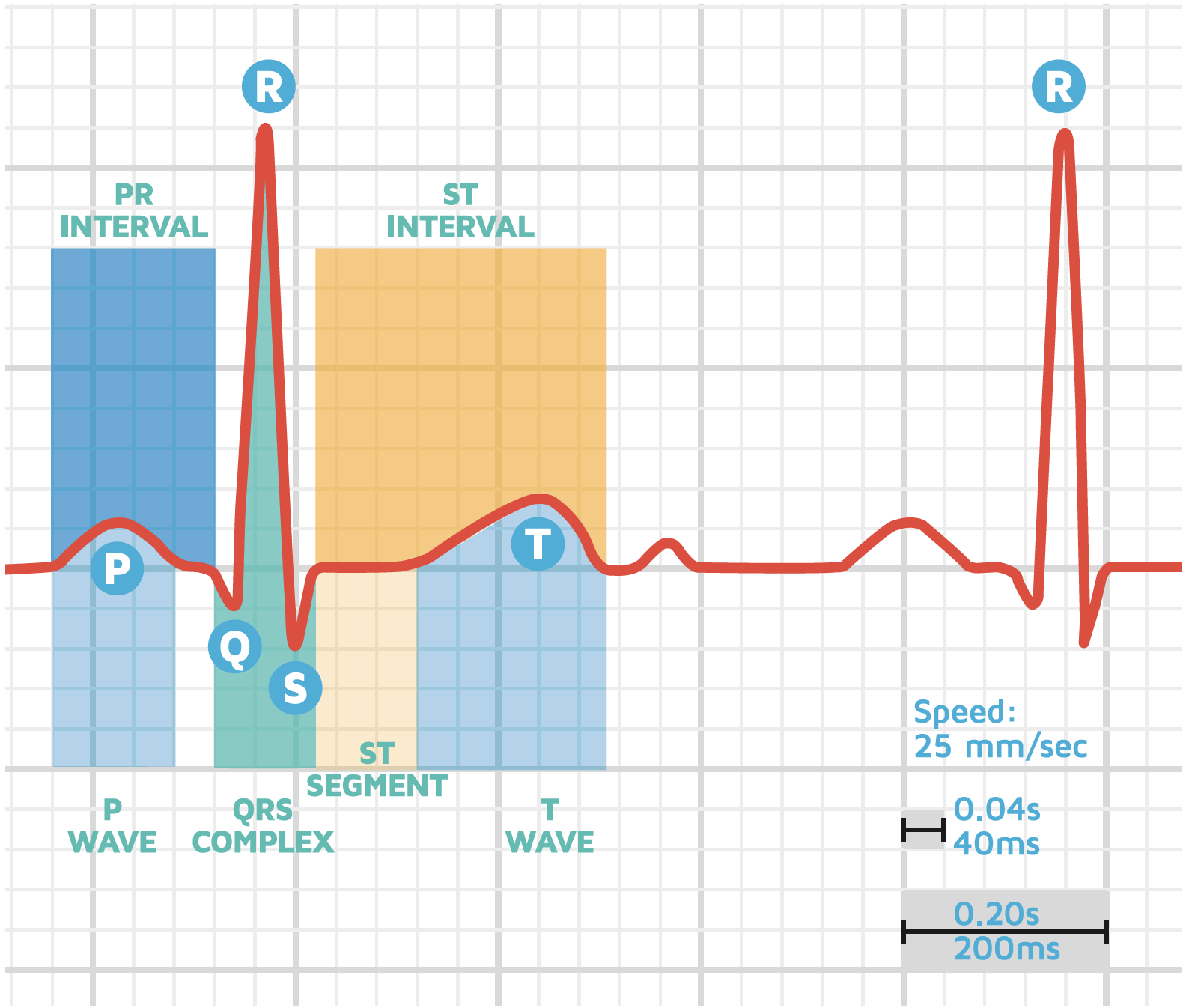 How to read your ECG – BUZUD Singapore